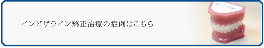 インビザライン矯正治療の症例はこちら