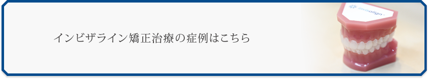 インビザライン矯正治療の症例はこちら